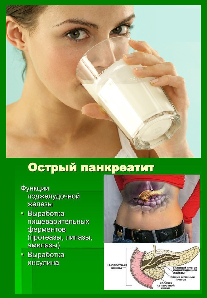 Можно пить кефир при поджелудочной железе. Молоко панкреатит. Можно пить молоко при панкреатите. Что можно пить с молоком. Кефир панкреатит.
