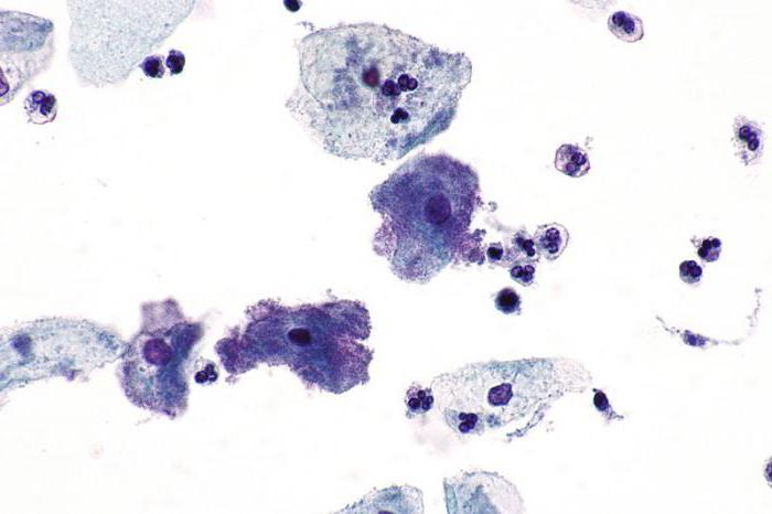 цитограмма бактериального вагиноза