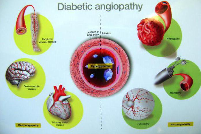 Диабетическая макроангиопатия
