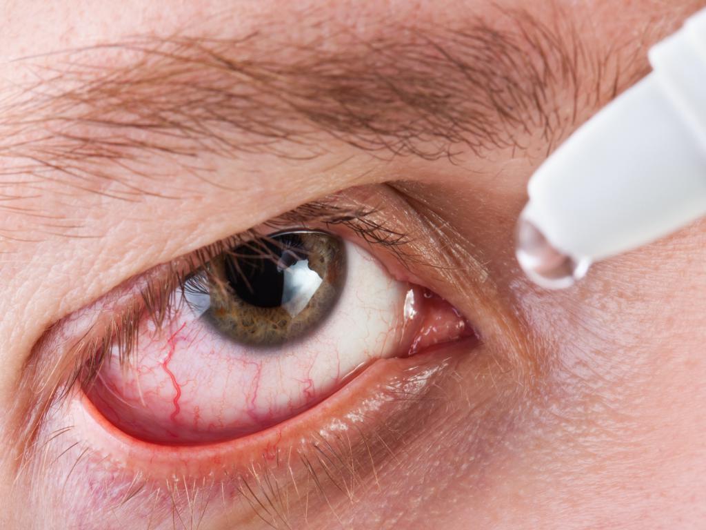 дистрофия сетчатки глаза лечение