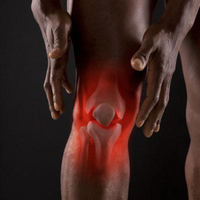 признаки артрита коленного сустава симптомы 