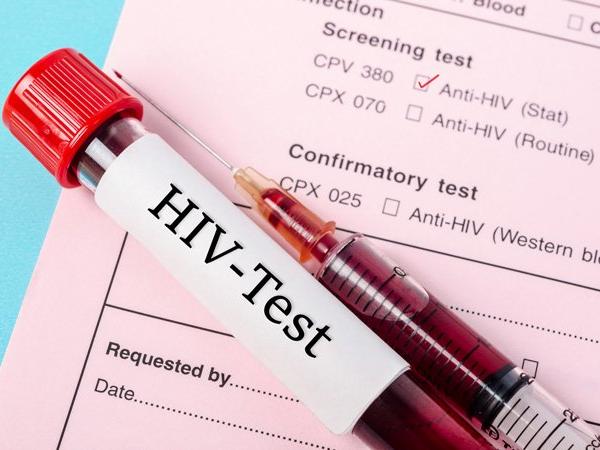 анализ крови на ВИЧ