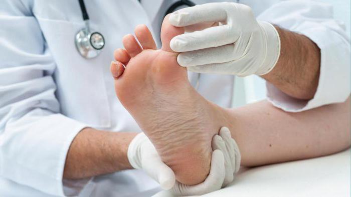 как лечить артрит на пальцах ног 