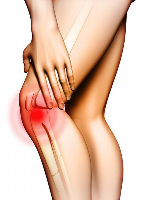 артрит коленного сустава лечение