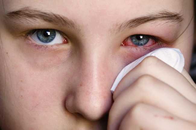Чем промывать глаза при конъюнктивите у ребенка?