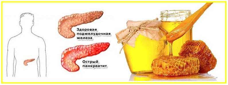 Мёд при панкреатите