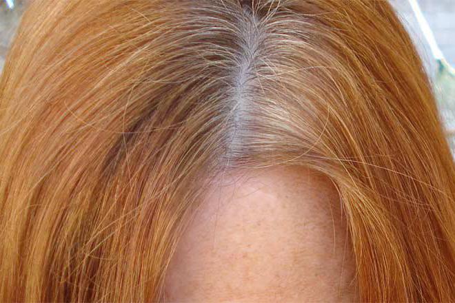 себорейный дерматит волосистой части головы у ребенка 