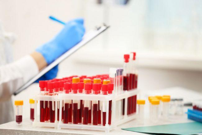 обследование крови и антитела к гепатиту б