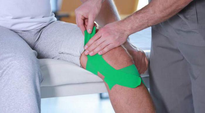 артрит коленного сустава методы лечения