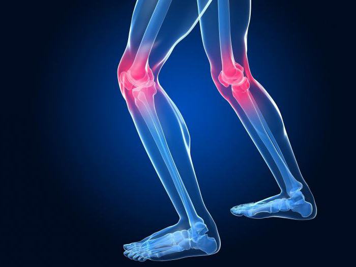 артрит коленного сустава лечение народными средствами