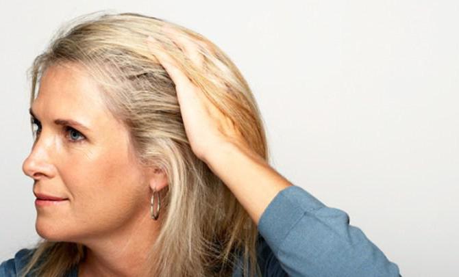 себорейный дерматит волосистой части причины 